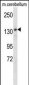 POLG Antibody (C-term)